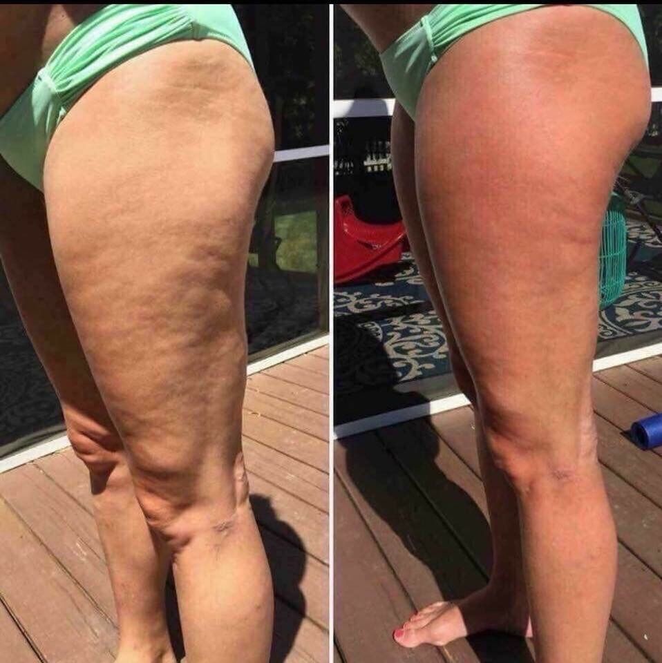 Huge Difference For Me