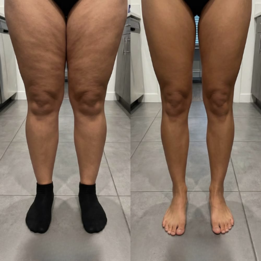 Love My Results 💗