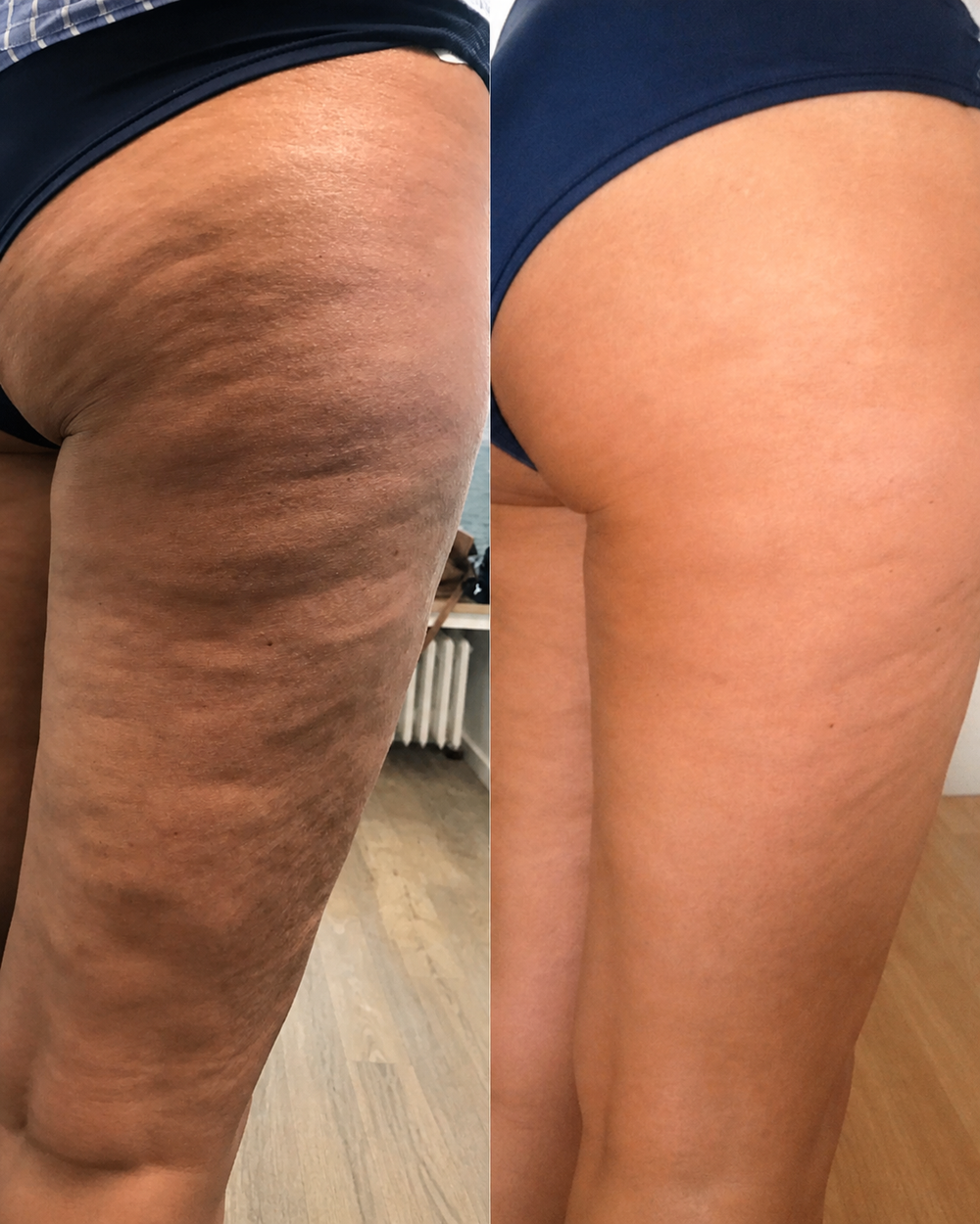 Amazing Results So Glad I Tried It!